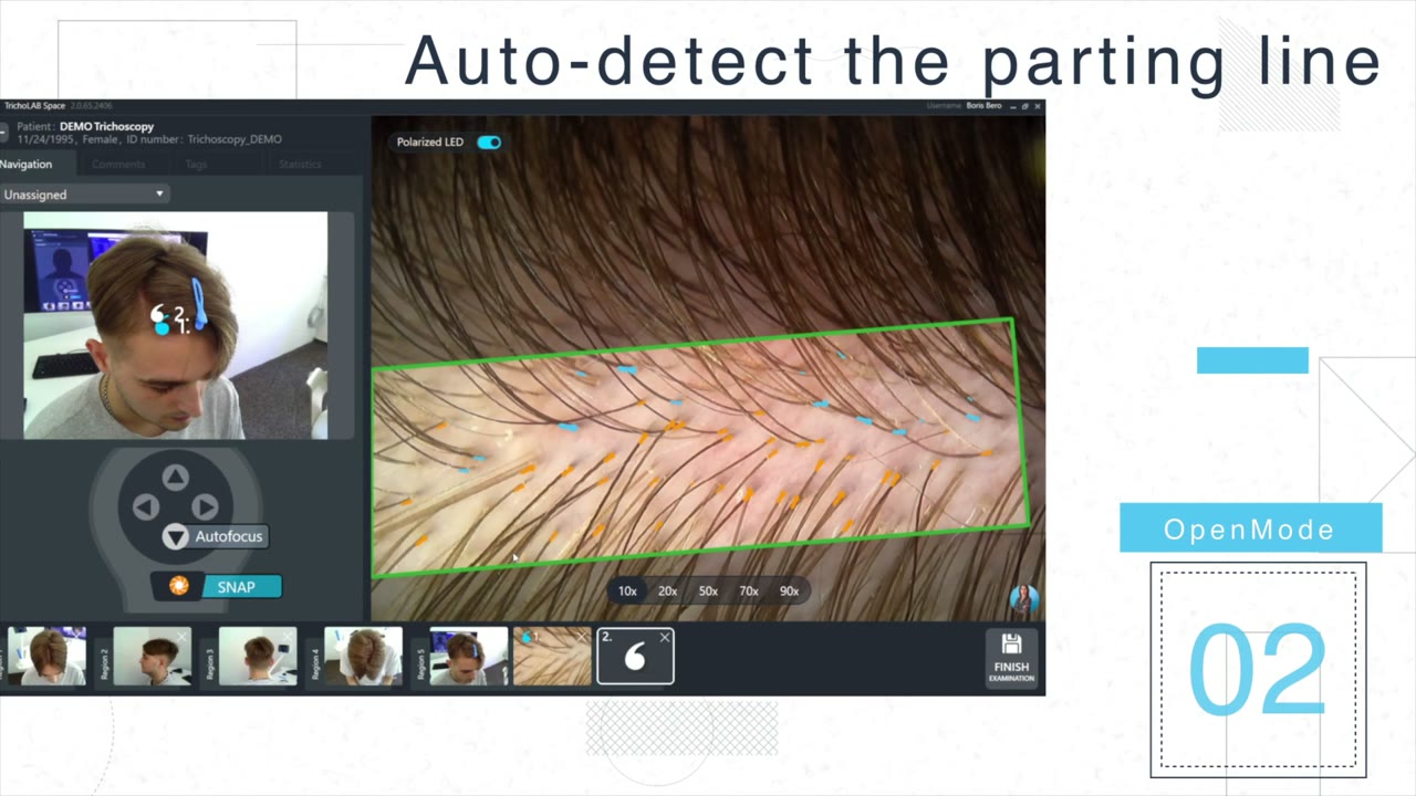 TrichoLAB Software Demo