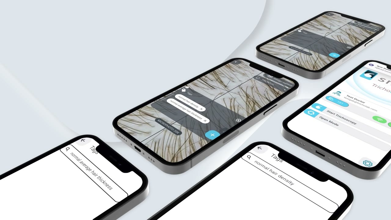 TrichoLAB App Showcase